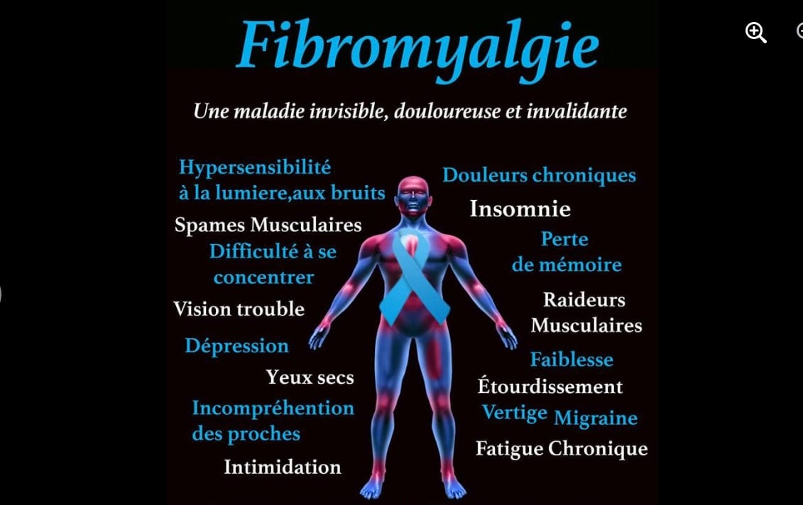 Fibromyalgie